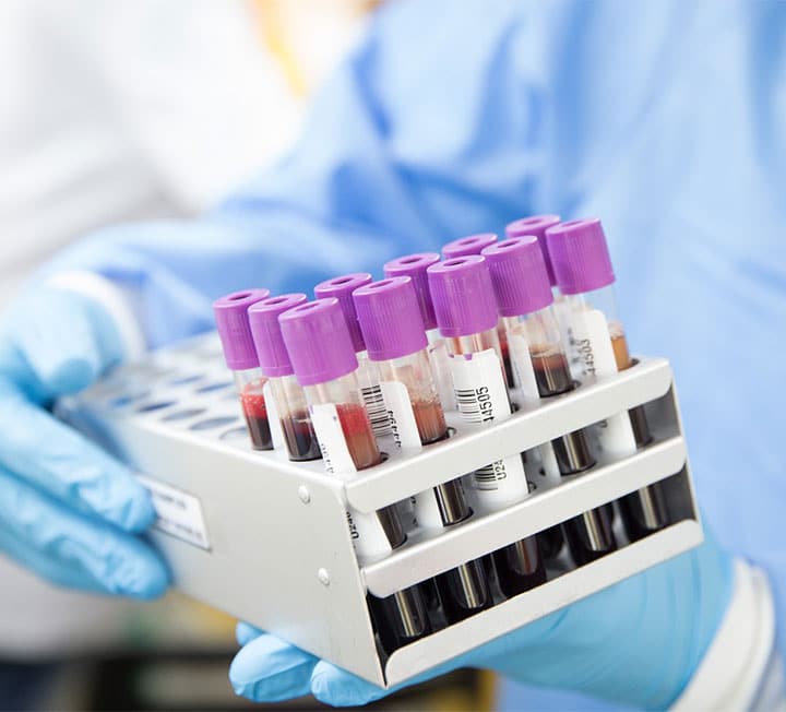 richih insulin syringe precision