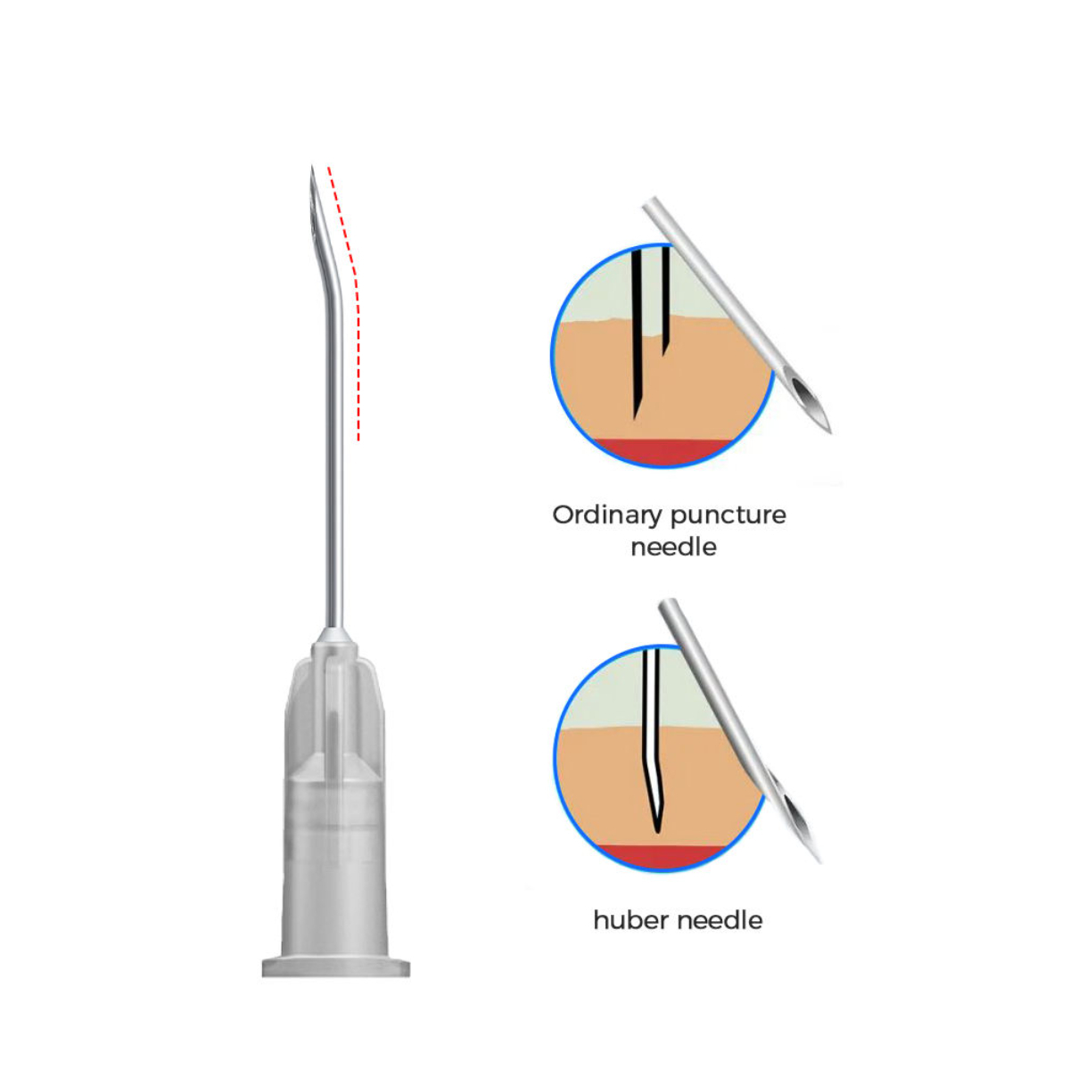 Reliable Best Quality Disposable Y Type Huber Needles - Image 5